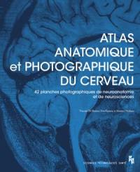 Atlas anatomique et photographique du cerveau : 42 planches (dont 41 photographiques) pour les passionnés de neuroanatomie et de neurosciences
