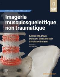 Imagerie musculosquelettique non traumatique