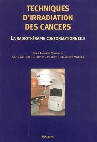 Techniques d'irradiation des cancers : la radiothérapie conformationnelle