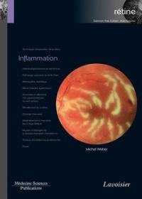 Rétine. Vol. 4. Inflammation
