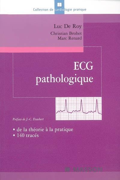 ECG pathologique : de la théorie à la pratique, 140 tracés