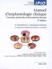 Manuel d'implantologie clinique : concepts, protocoles et innovations récentes