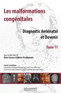 Les malformations congénitales : diagnostic anténatal et devenir. Vol. 11