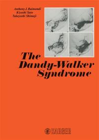 The Dandy-Walker syndrome