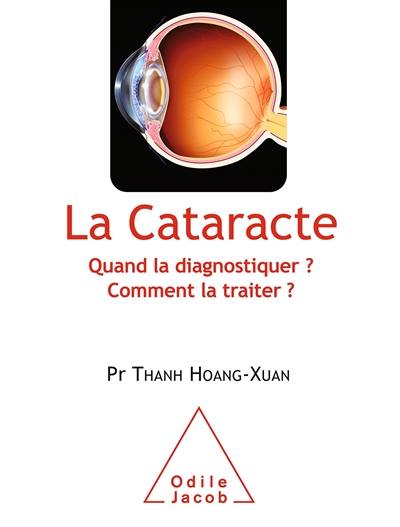 La cataracte : quand la diagnostiquer ? comment la traiter ?