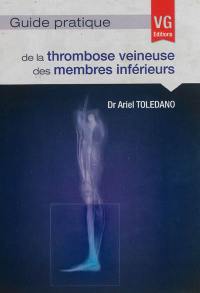 Guide pratique de la thrombose veineuse des membres inférieurs