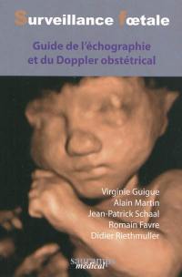 Surveillance foetale : guide de l'echographie et du Doppler obstétrical