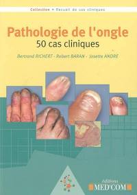 Pathologie de l'ongle : 50 cas cliniques