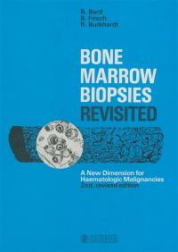 Bone marrow biopsies revisited
