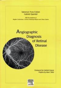 Angiographic diagnosis of retinal desease