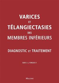 Varices et télangiectasies des membres inferieurs : diagnostic et traitement