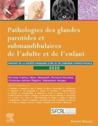 Pathologies des glandes parotides et submandibulaires de l'adulte et de l'enfant : rapport de la Société française d'ORL et de chirurgie cervico-faciale 2020