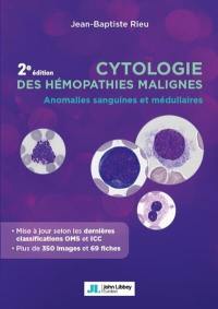 Cytologie des hémopathies malignes : anomalies sanguines et médullaires