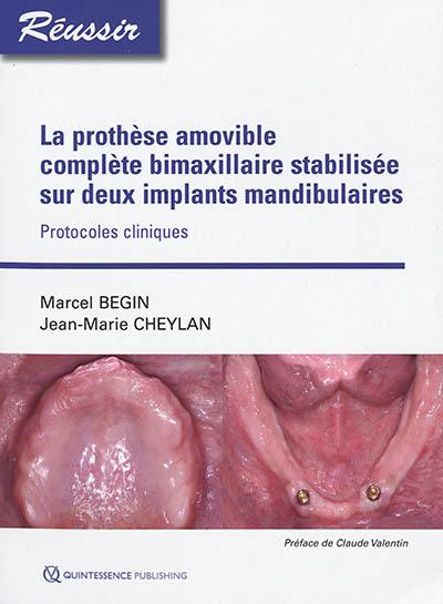 La prothèse amovible complète bimaxilliaire stabilisée sur deux implants mandibulaires : protocoles cliniques
