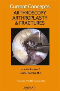Arthroscopy, arthroplasty & fractures : current concepts
