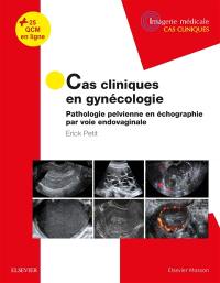 Cas cliniques en gynécologie : pathologie pelvienne en échographie par voie endovaginale