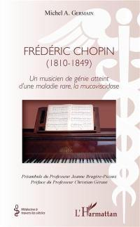 Frédéric Chopin (1810-1849) : un musicien de génie atteint d'une maladie rare, la mucoviscidose