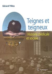 Teignes et teigneux : histoire médicale et sociale