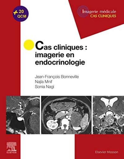 Cas cliniques : imagerie en endocrinologie