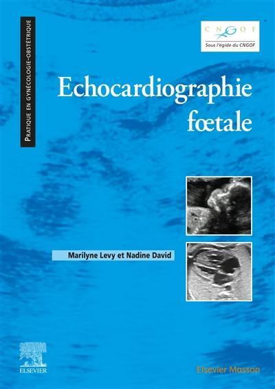 Echocardiographie foetale