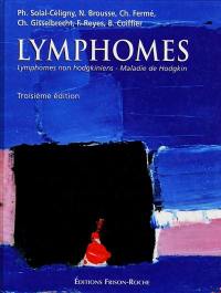 Lymphomes : lymphomes non hodgkiniens, maladie de Hodgkin