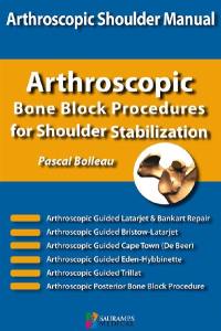 Arthroscopic shoulder manual : arthroscopic bone block procedures for shoulder stabilization