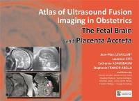 Atlas of ultrasound fusion imaging in obstetrics : the fetal brain and placenta accreta