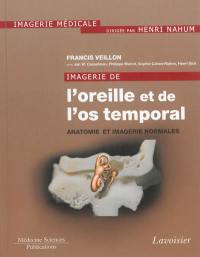 Imagerie de l'oreille et de l'os temporal. Vol. 1. Anatomie et imagerie normales