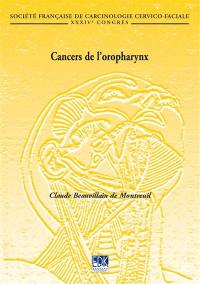 Cancers de l'oropharynx