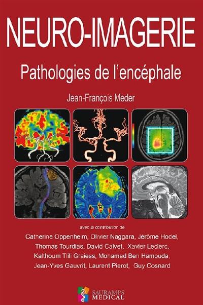 Neuro-imagerie : pathologies de l'encéphale