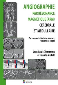 Angiographie par résonance magnétique (ARM) cérébrale et médullaire : techniques, indications, résultats, variantes et pièges