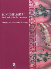 Mini-implants : l'orthodontie de demain