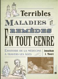 Terribles maladies et remèdes en tout genre : l'histoire de la médecine à travers les âges
