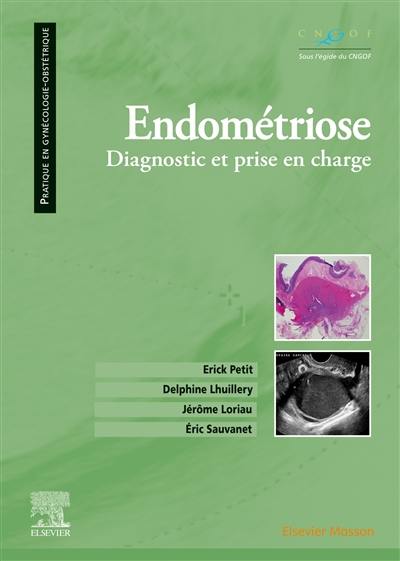 Endométriose : diagnostic et prise en charge
