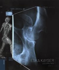 Eska Kayser : les opalines