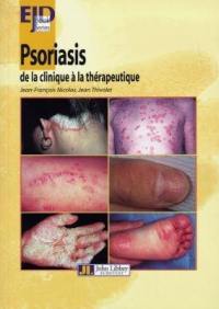 European Journal of Dermatology. Psoriasis : de la clinique à la thérapeutique