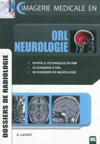 Imagerie médicale en ORL, neurologie