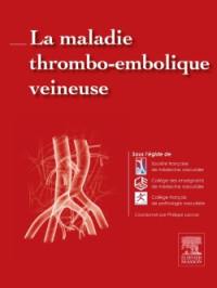La maladie thromboembolique veineuse