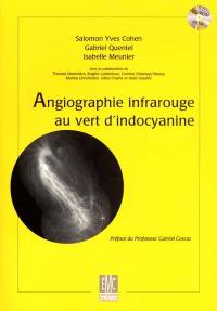 Angiographie infrarouge au vert d'indocyanine